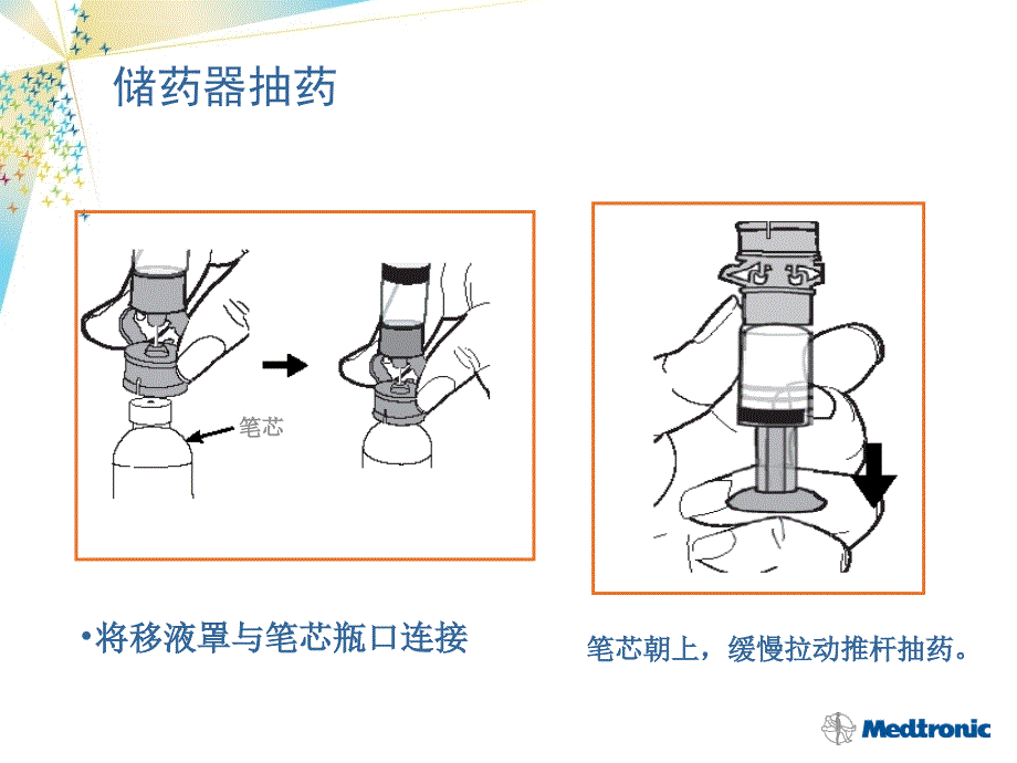 美敦力管路的植入与输注部位的管理ppt课件_第4页