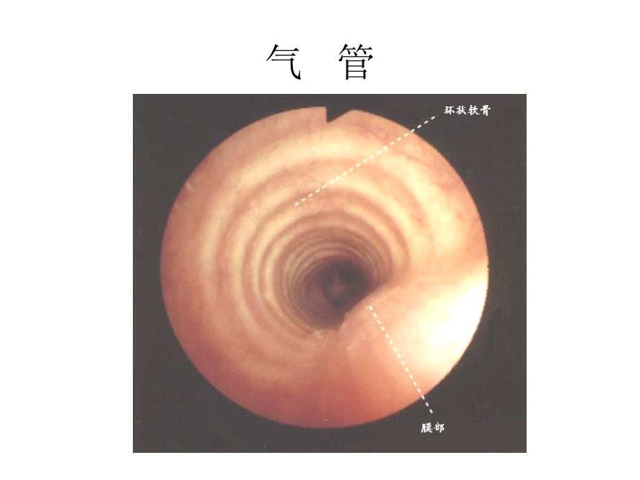 气管镜图谱ppt课件_第4页