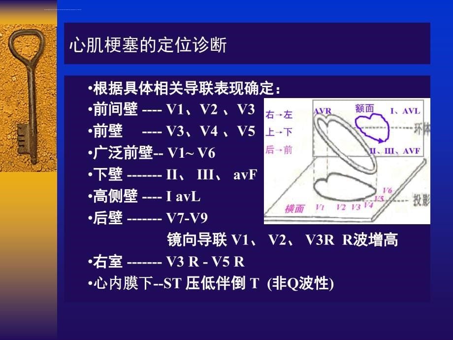 常见心电图分析及判断2016ppt课件_第5页