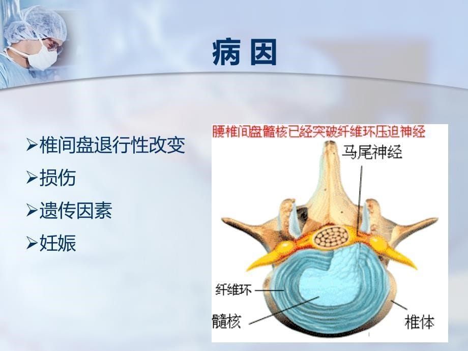 腰椎间盘突出症的术后护理ppt课件_第5页