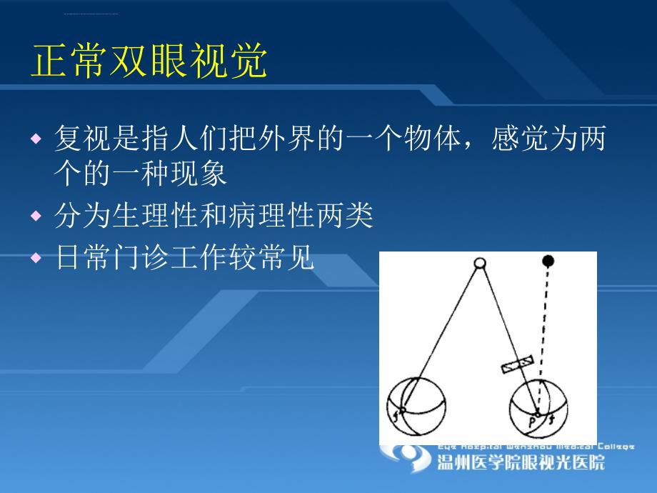 复视分析ppt课件_第4页