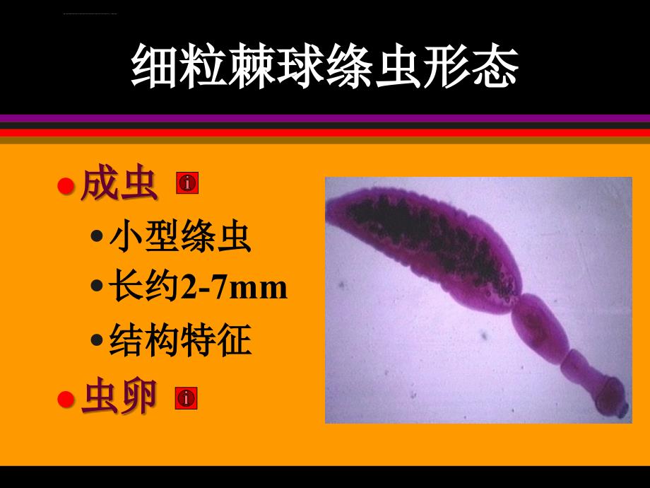 棘球蚴病okppt课件_第3页