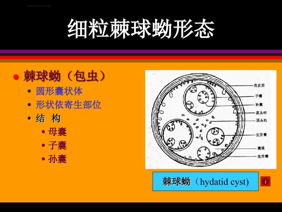 棘球蚴病okppt课件_第4页