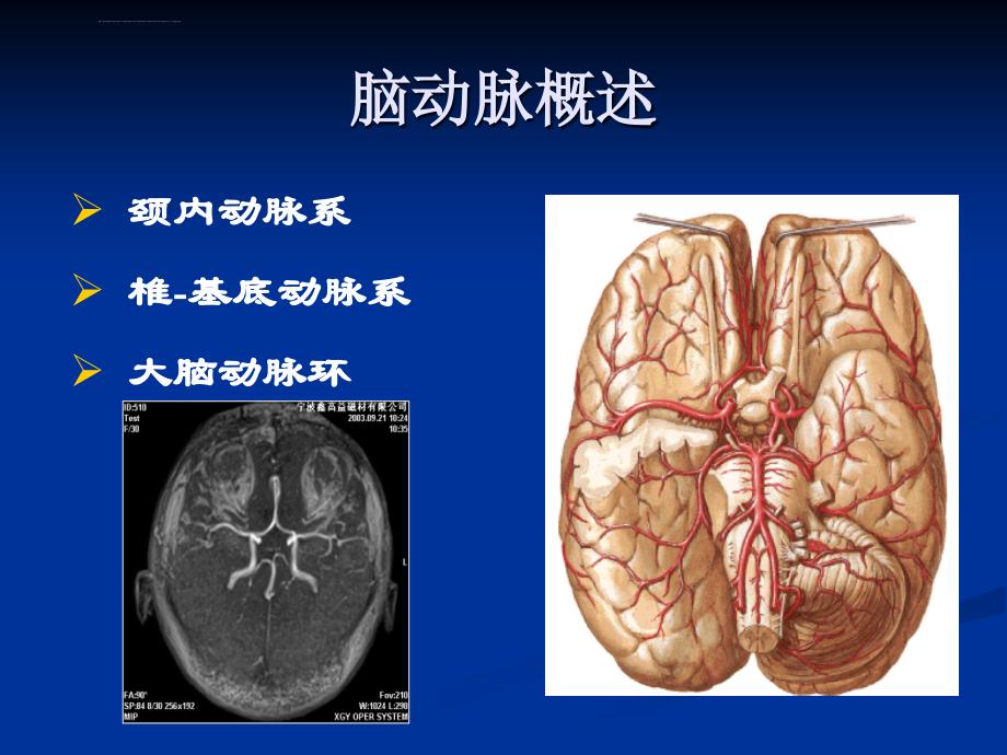 颅内和椎管内血管性疾病ppt课件_第2页