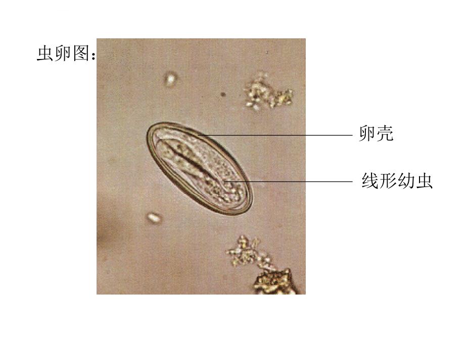 蛲鞭钩ppt课件_第3页