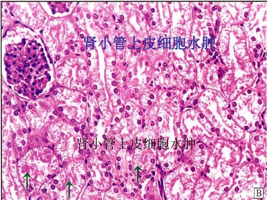 湖北中医大病理学实验考试ppt课件_第4页