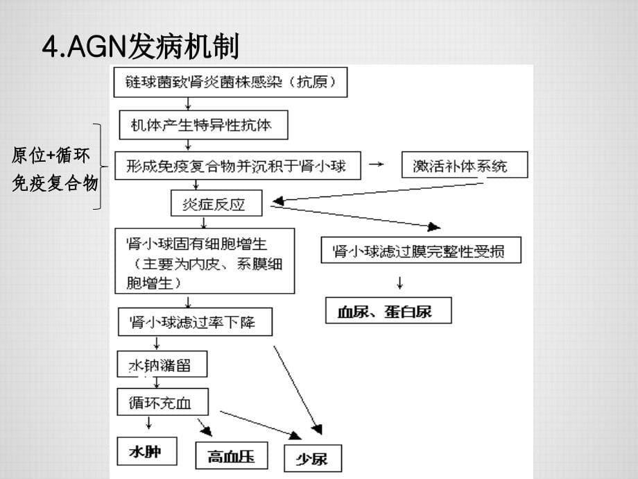 急性肾小球肾炎ppt课件_第5页