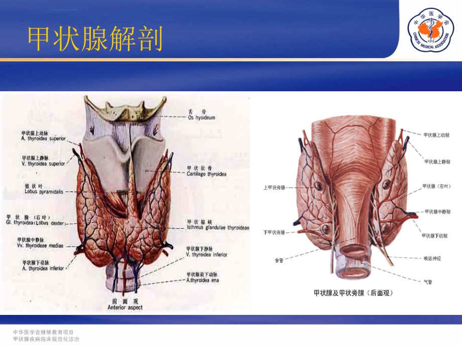 甲状腺炎ppt课件_第2页