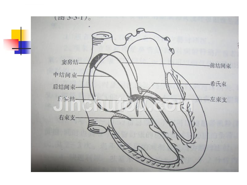 常见心律失常的心电图表现与解读ppt课件_第2页