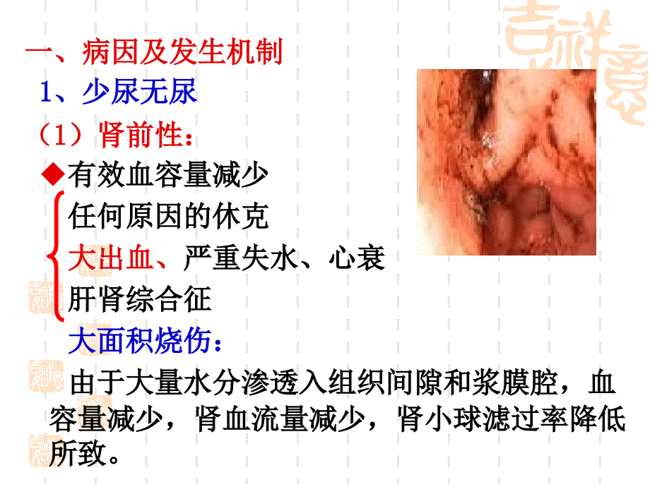 诊断学：少尿无尿多尿ppt课件_第3页