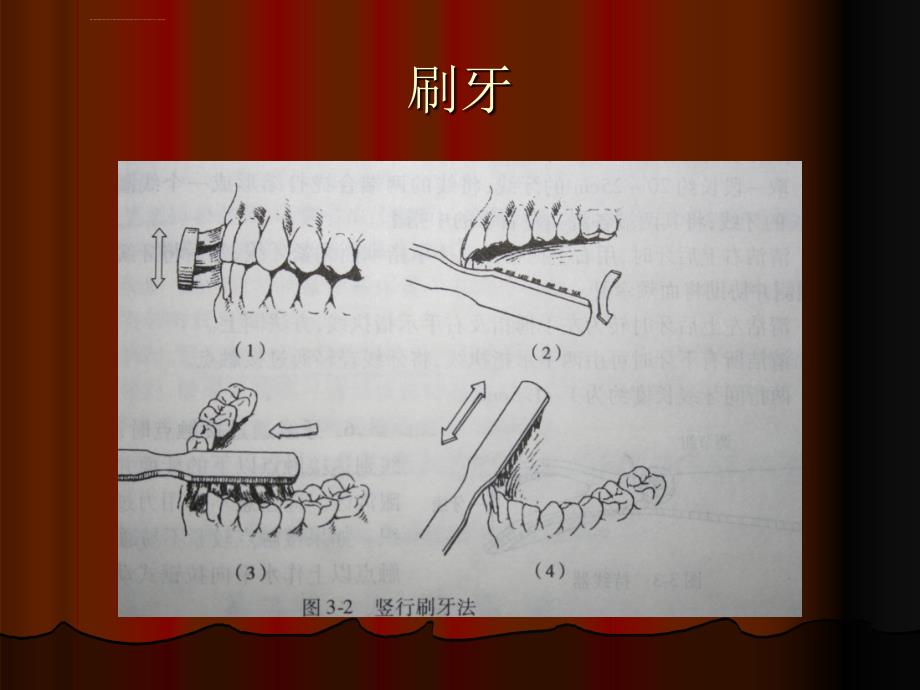 口腔医学第三章口腔卫生保健粘膜病ppt课件_第3页