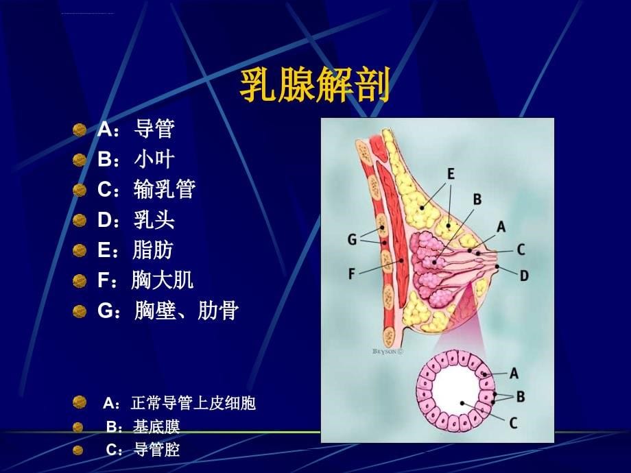 培训资料--乳腺疾病的超声诊断_第5页