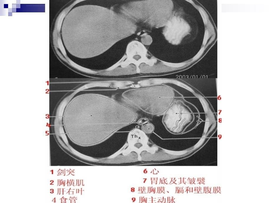 肝脏疾病ct表现ppt课件_第5页