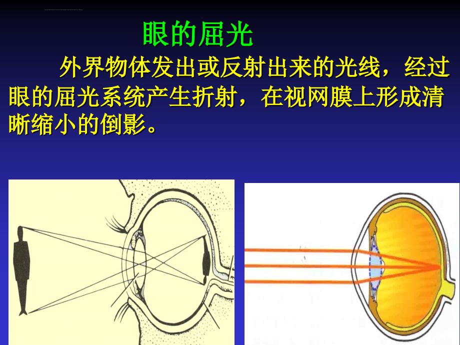 屈光不正与老视ppt培训课件_第2页