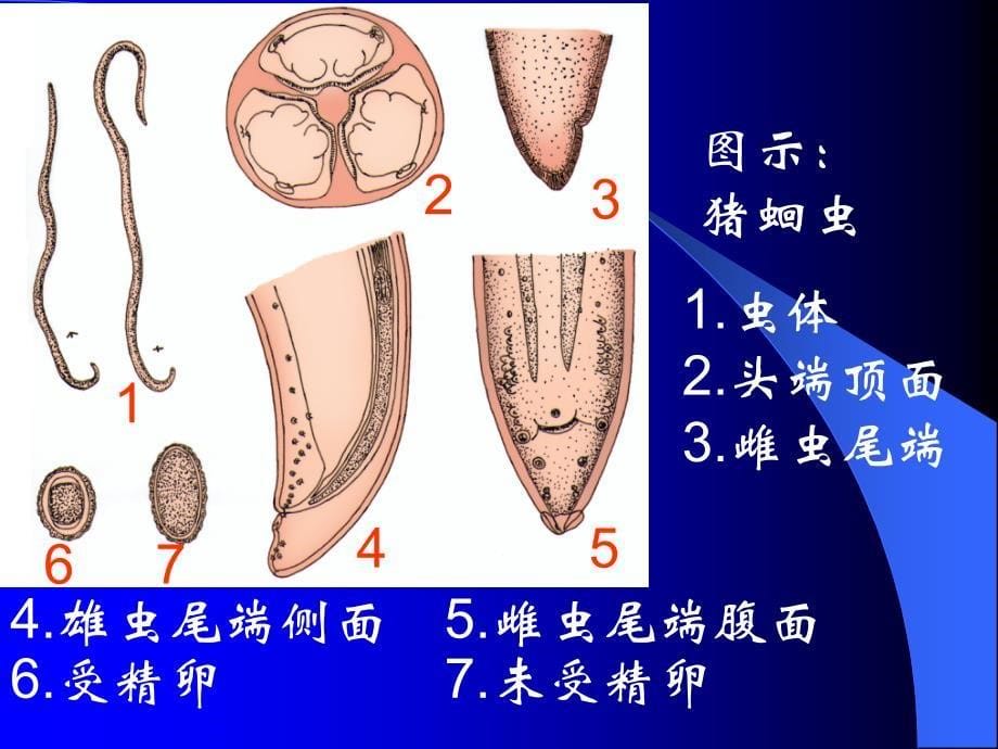 蛔虫及蛔虫病ppt课件_第5页