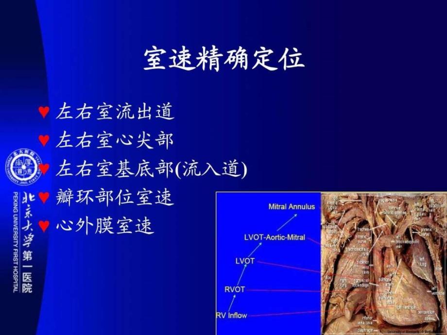 丁燕生室速起源定位ppt培训课件_第3页