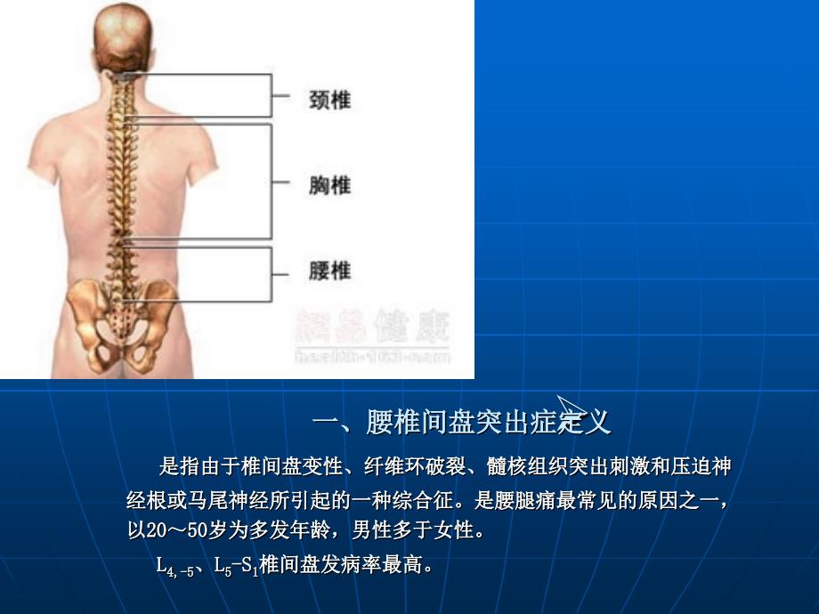 脊柱骨科护理进展ppt课件_第3页