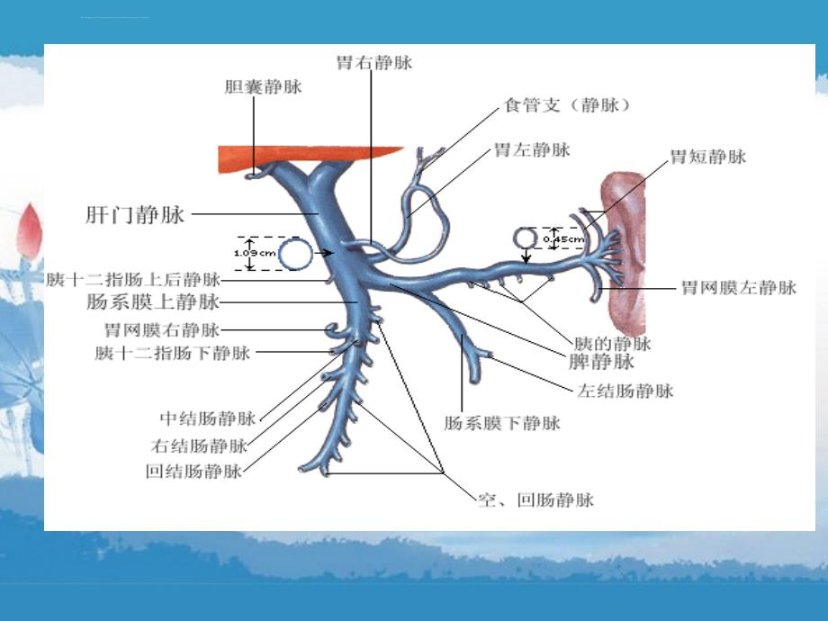 肝小静脉闭塞综合征ppt课件_第3页