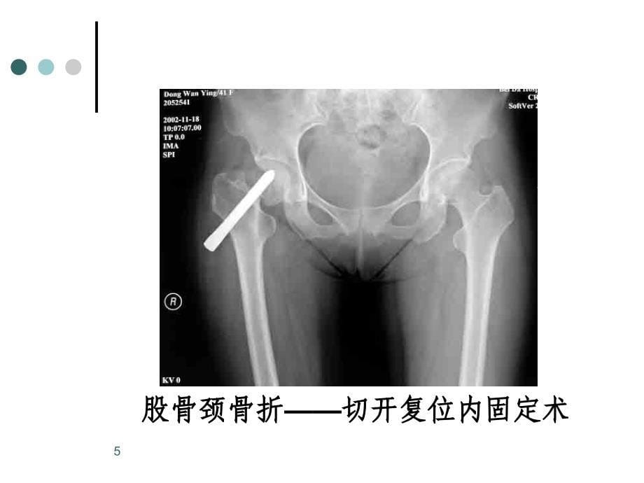 课件001第一章绪论第二章无菌术_第5页