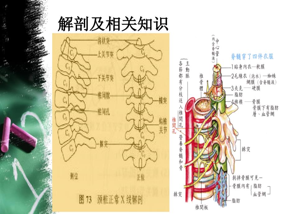 颈椎骨折并发症观察与护理ppt课件_第3页