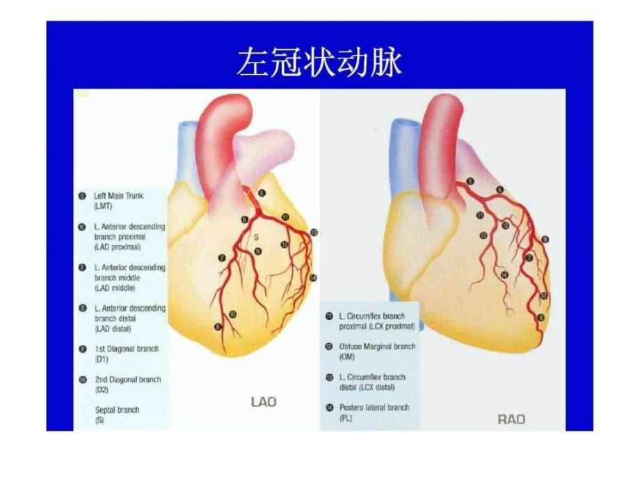 冠状动脉造影投照体位ppt培训课件_第3页