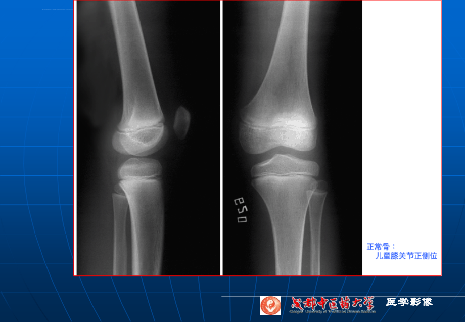 骨、关节系统实验课件_第4页