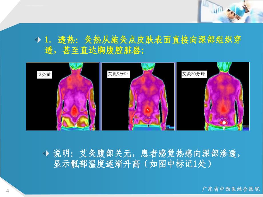 热敏灸疗法治疗腰突症_第4页