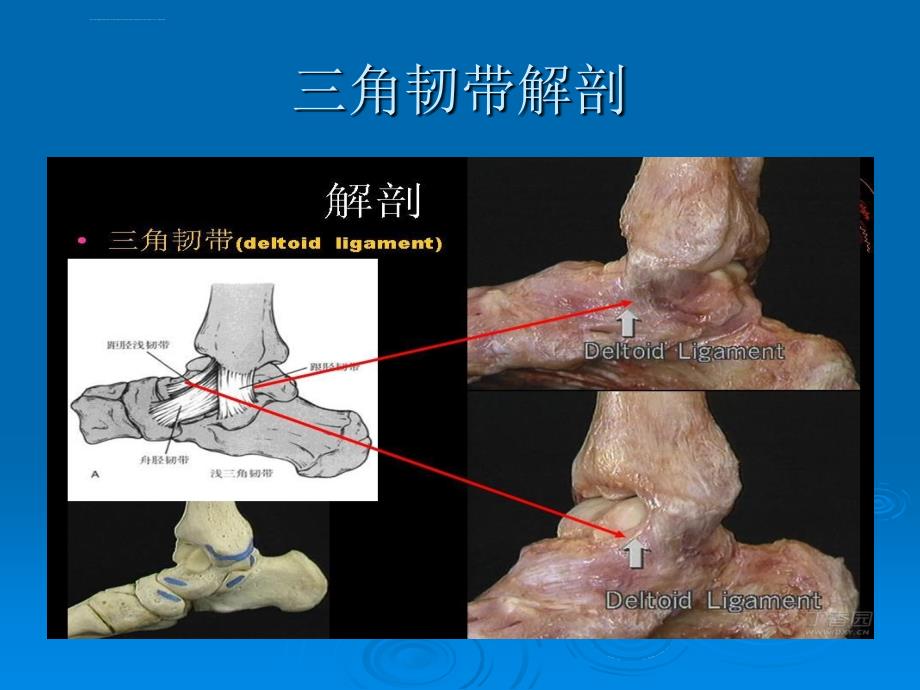 踝关节骨折laugehansen分型ppt课件_第4页