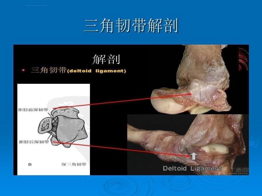 踝关节骨折laugehansen分型ppt课件_第5页