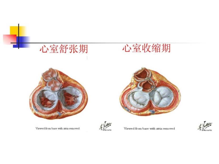 件主动脉瓣关闭不全ppt培训课件_第2页