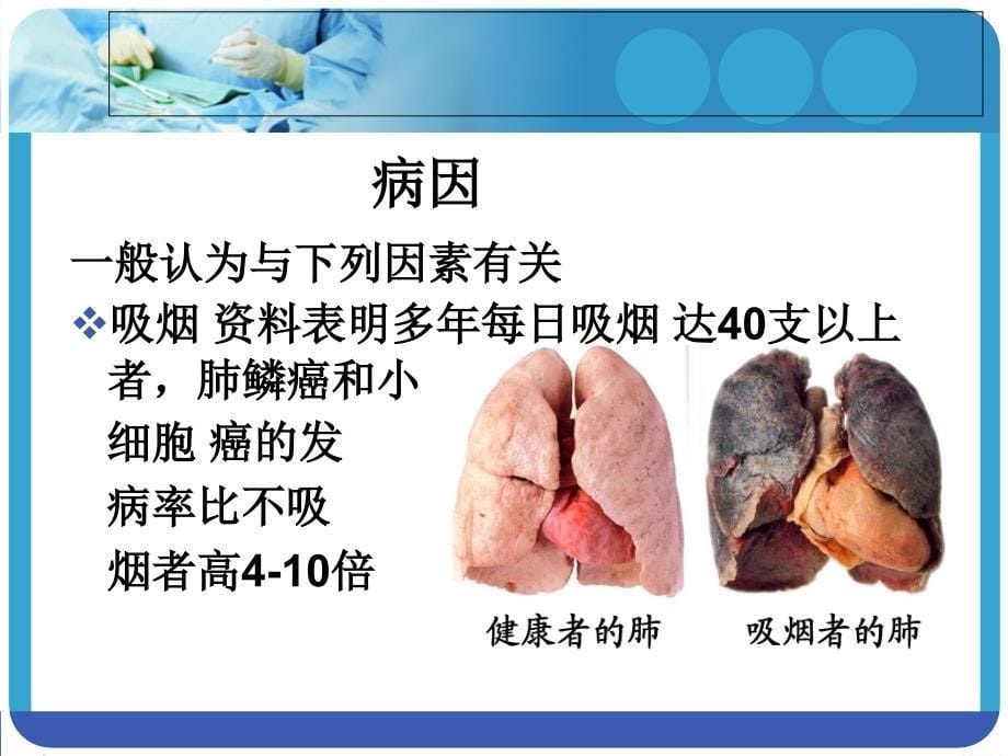 肺癌病人围手术期护理ppt课件_第5页