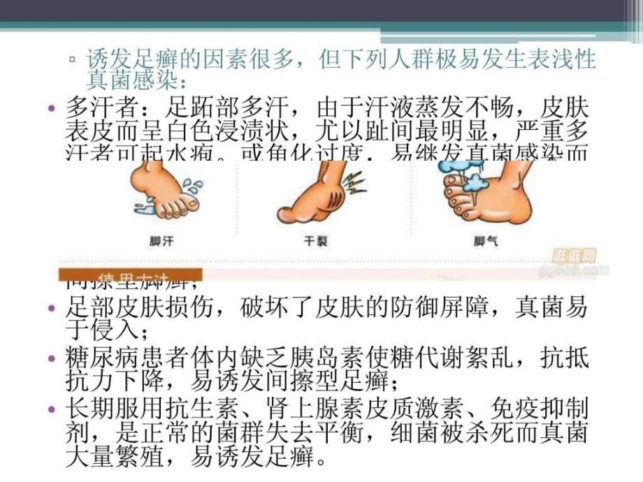 临床医学手足癣（病）ppt培训课件_第5页