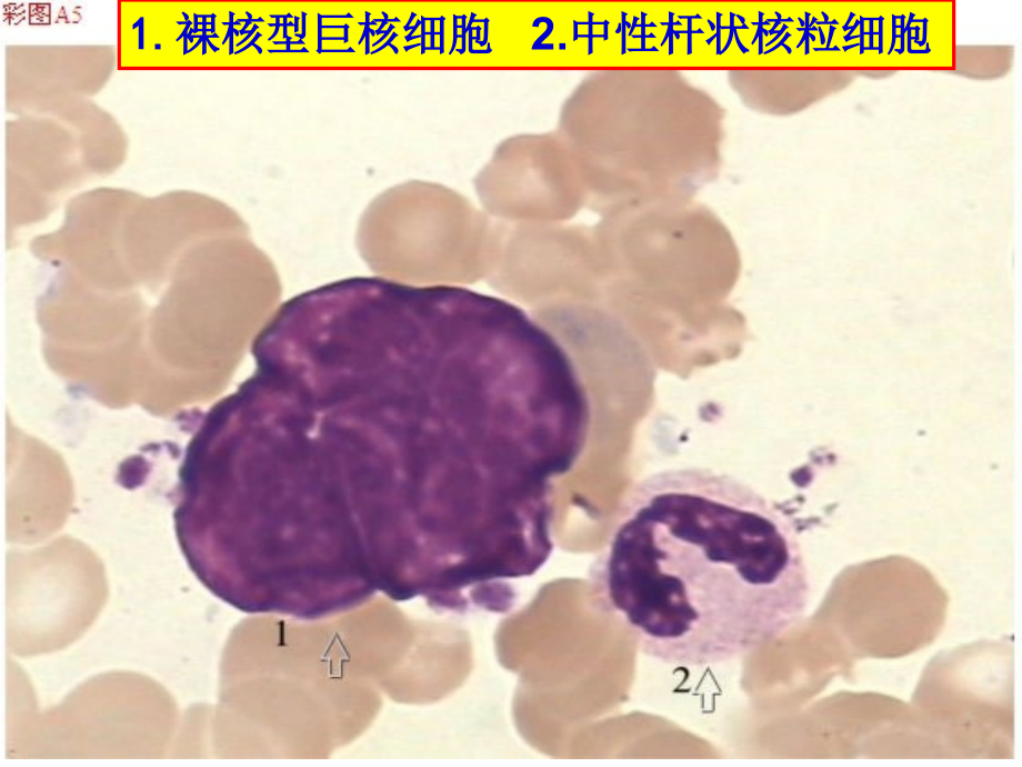 骨髓细胞图谱ppt课件_第3页