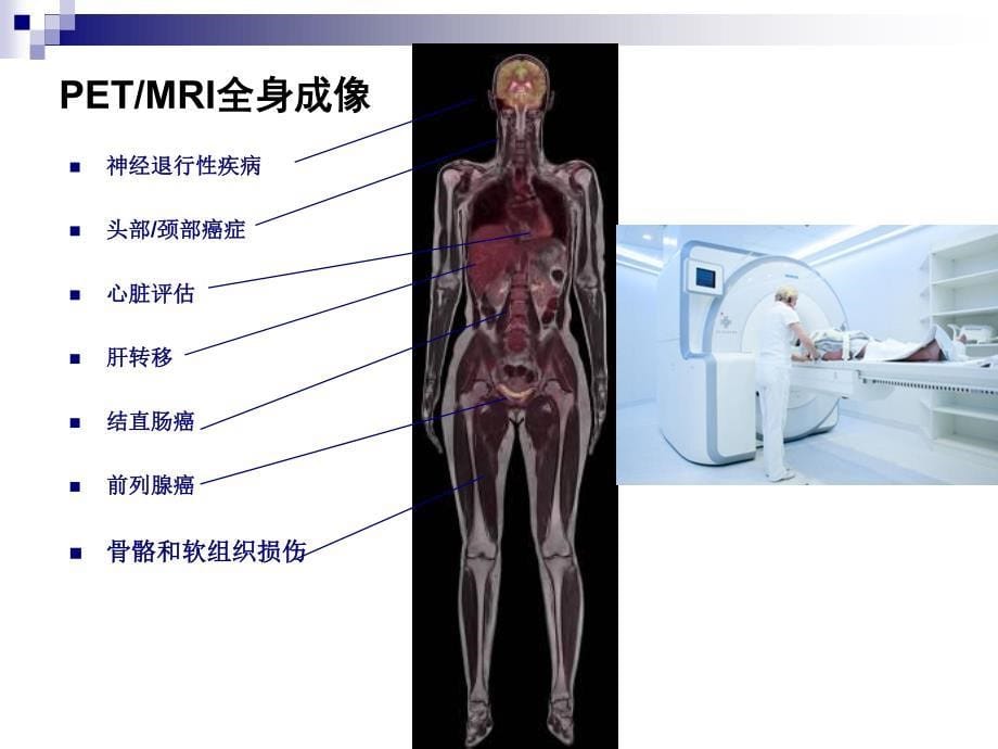 华山医院petmri申请汇报_第5页