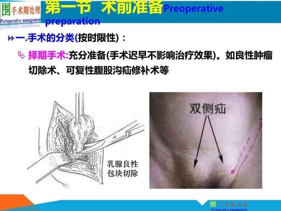 围手术期处理(2)ppt培训课件_第5页