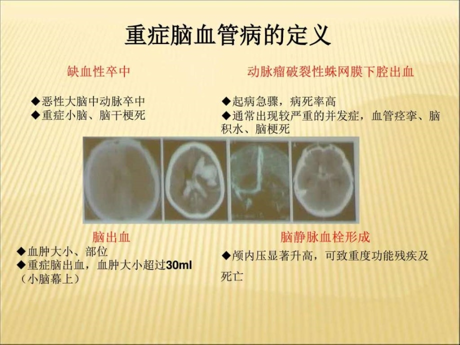 中国重症脑血管病管理共识ppt培训课件_第2页