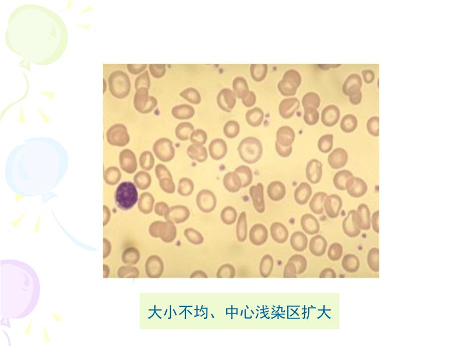 红细胞形态检验ppt课件_第4页
