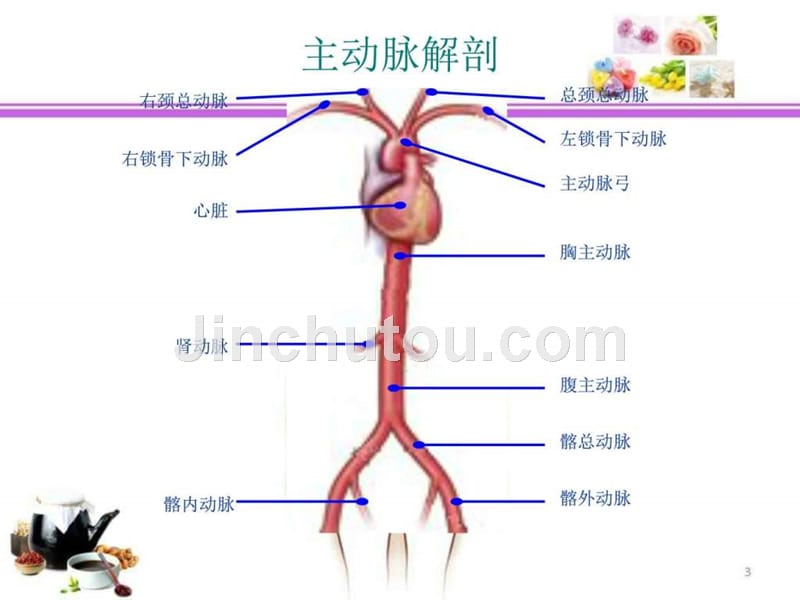 腹主动脉瘤之介入治疗ppt课件_第3页