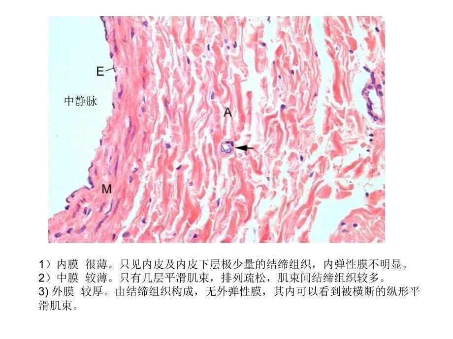 循环系统大动脉_第5页