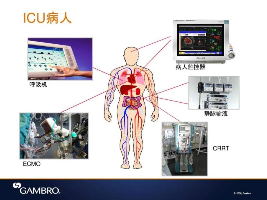 五crrt指征反指征ppt培训课件_第3页