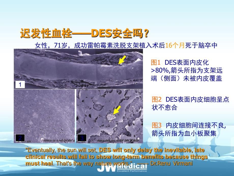 常用支架的特点_第3页