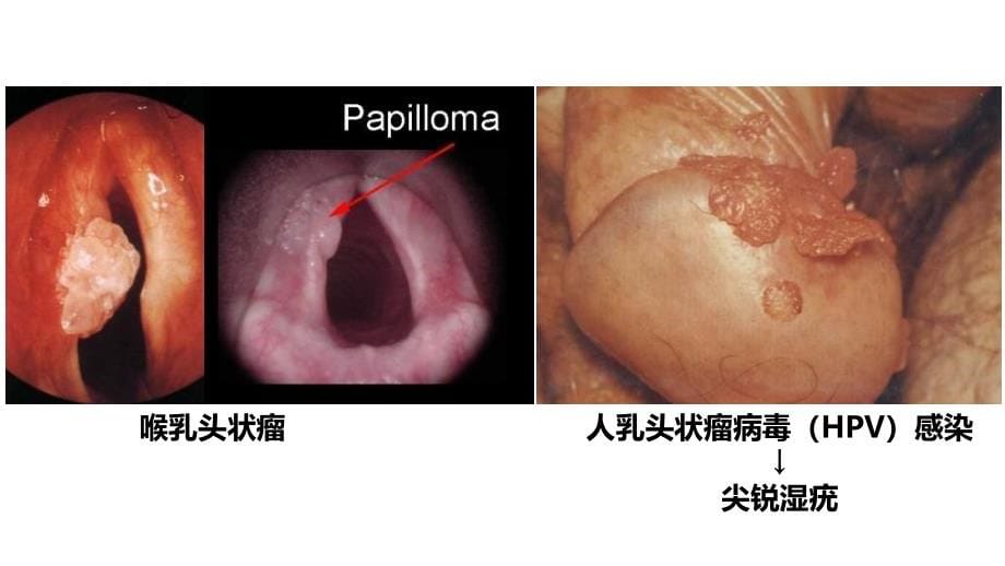 肿瘤-3＿常见肿瘤_第5页