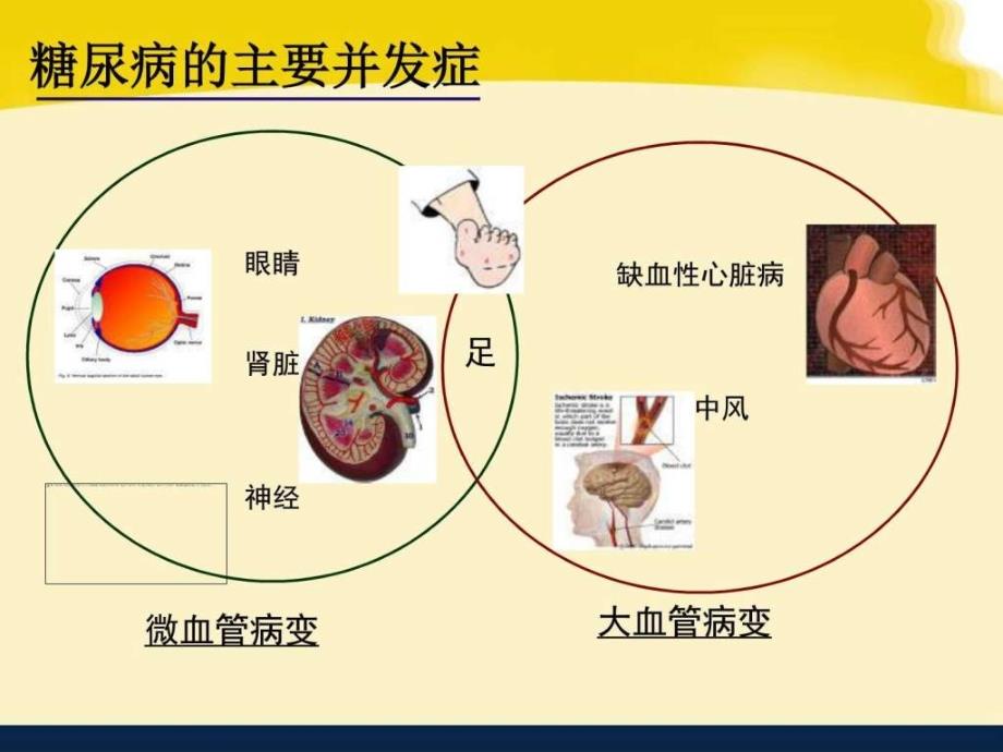 糖尿病肾病的饮食健康教育ppt培训课件_第2页