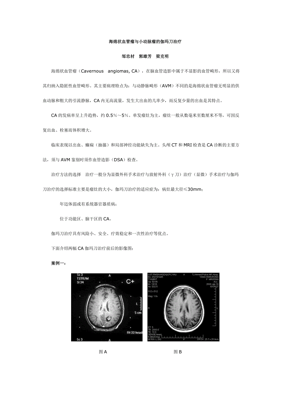 海绵状血管瘤与小动脉瘤的伽玛刀治疗_第1页