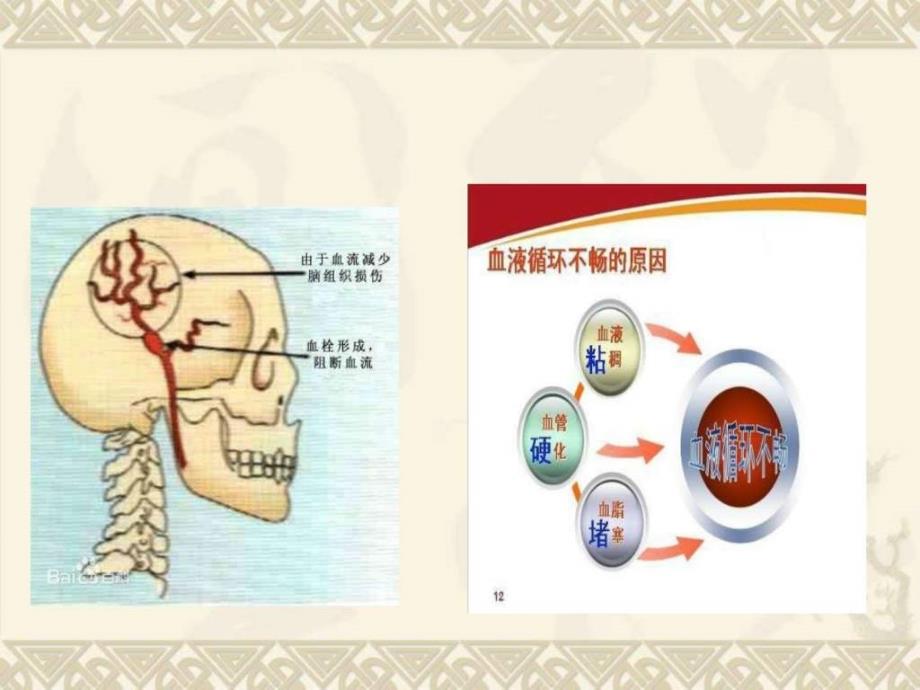 脑供血不足患者的护理20153赵文霞课件_第4页