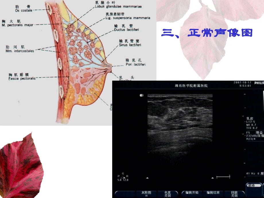 乳腺和甲状腺的超声学检查_第4页