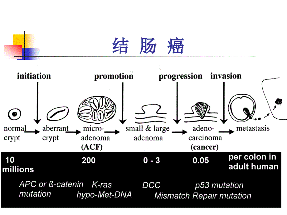 普外-结肠癌_第2页