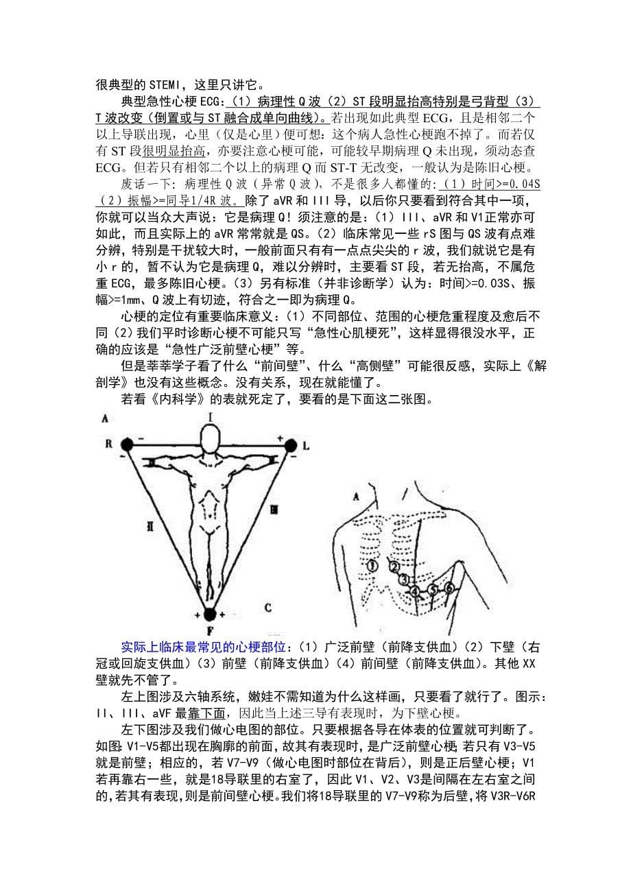 看懂和处理常见心电图_第5页