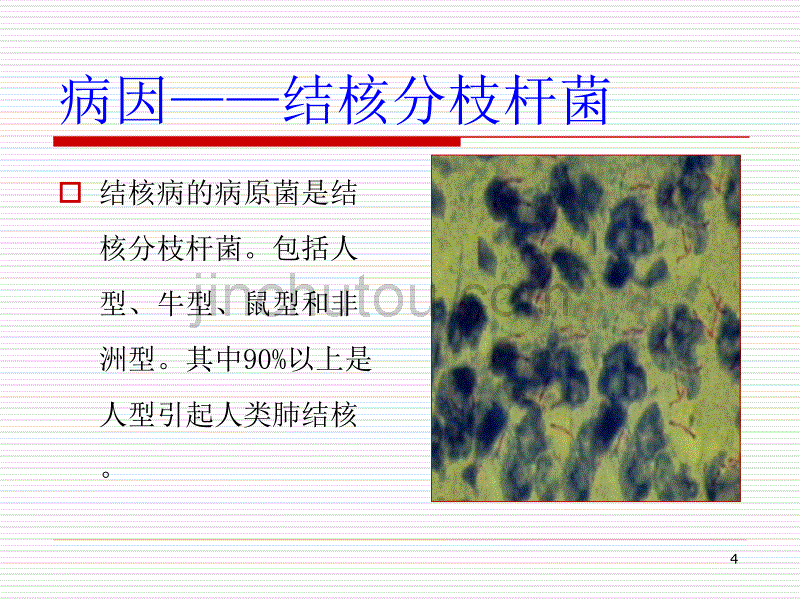 肺结核防护ppt课件_第4页