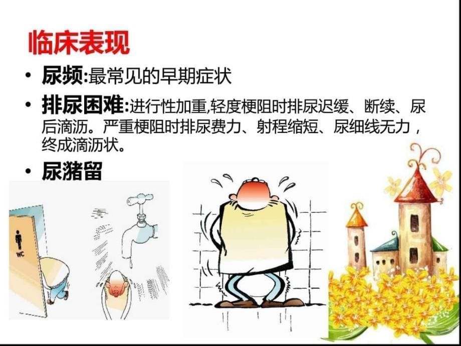 前列腺增生症预防医学医药卫生专业资料ppt课件_第5页